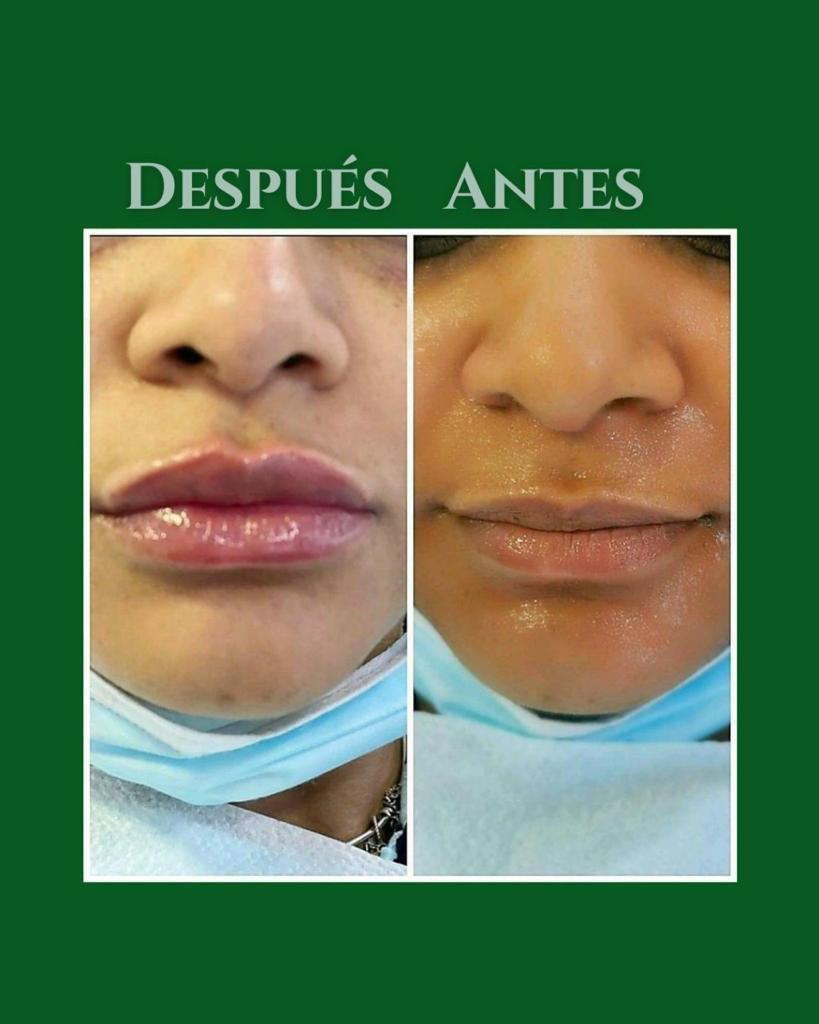 Productos Médicos - Regenyal Idea