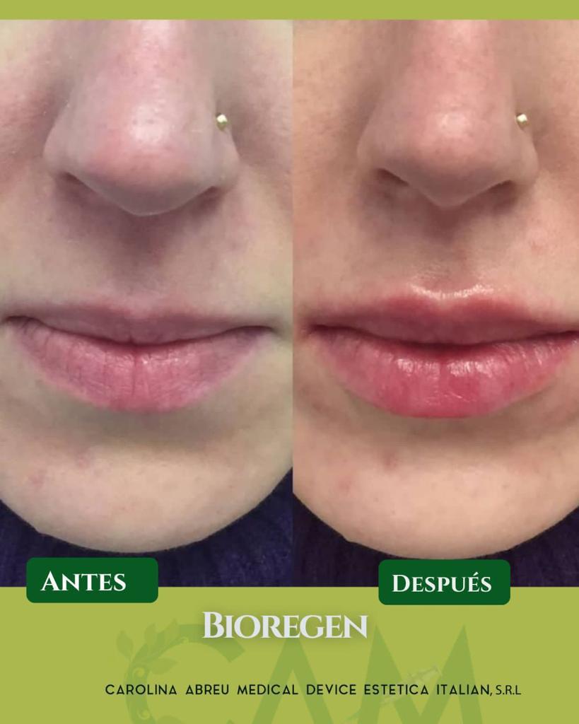 Productos Médicos - Bioregen