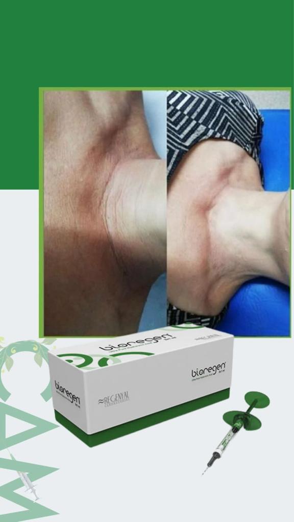 Productos Médicos - Bioregen