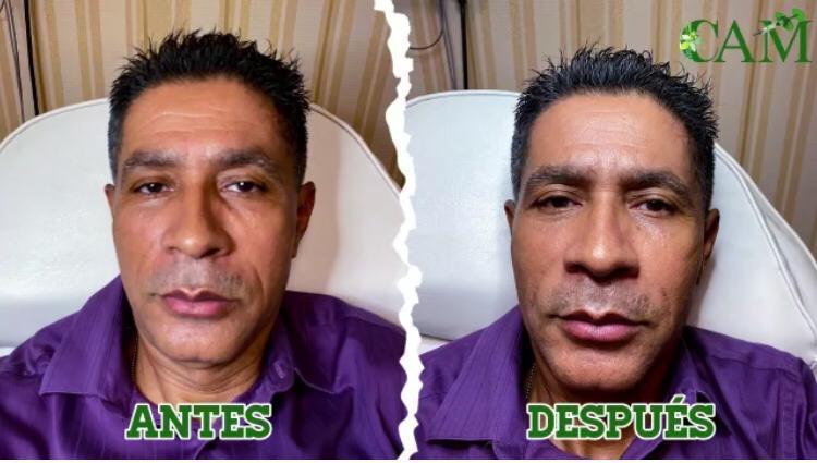 Productos Médicos - Regenyal Idea