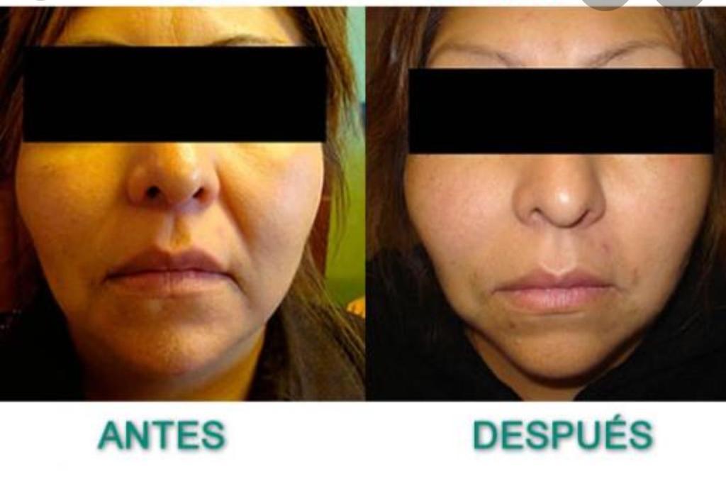 Productos Médicos - Regenyal Idea